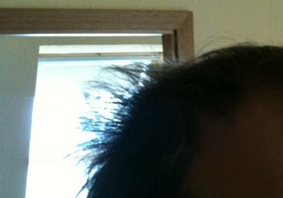 hair